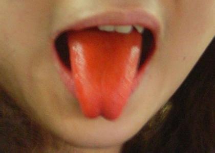 吃槟榔舌头疼 吃过槟榔后舌头疼是怎么了