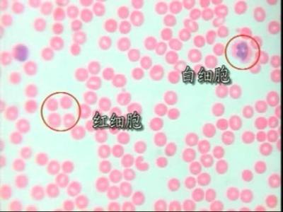 显微镜观察人血涂片 用显微镜观察人血永久涂片 初中生物实验