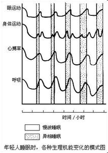 异相睡眠 什么是异相睡眠 异相睡眠的四阶段