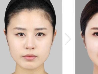 简单有效的瘦脸方法 史上最有效的瘦脸方法
