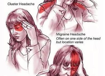 偏头痛的症状 对抗偏头痛的营养素