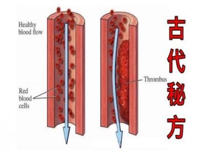 通血管的古法食療