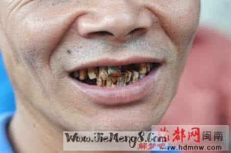 周公解梦梦见掉牙 周公解梦 掉牙 解梦 掉牙_周公解梦 掉牙