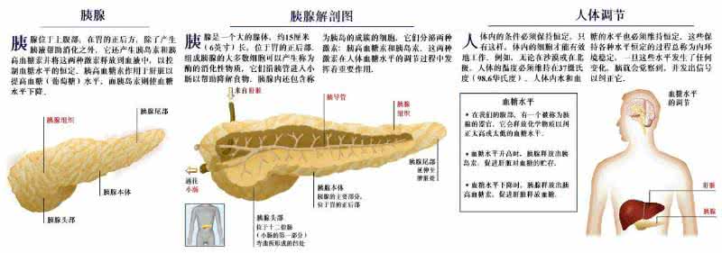 糖尿病并发症神经病变 经方治疗糖尿病神经病变并发症