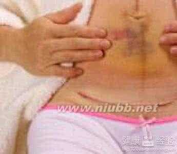 剖腹产后就有恶露吗 剖腹产后恶露多吗