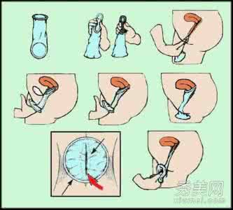 避孕套使用时间 性爱时怎样科学使用避孕套
