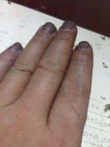 染发剂弄手上怎么洗 洗染发剂弄手上怎么洗