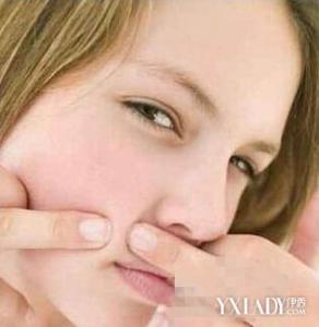 去除脸上痘痘的办法 长痘痘怎么办 脸上长痘痘怎么办用什么办法去除 痘痘告诉你哪里生病了