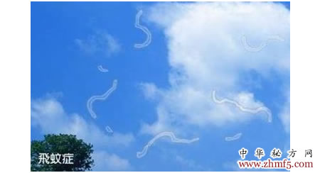 明目地黄丸 飞蚊症 转载 睛明饮治眼前飞蚊症