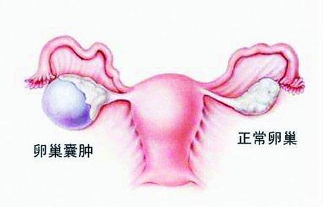 女子肚子痛取出四斤虫 女子肚子大得像孕妇原因令人惊呆了