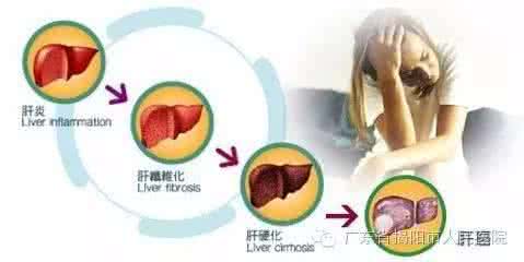 脂肪肝和肝纤维化鉴别 脂肪肝合并肝纤维化治愈一例