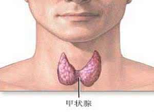 甲状腺肿大的治疗方法 甲状腺肿大能治愈吗 甲状腺肿大的治疗方法