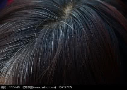健康之路白头发变黑发 健康之路白头发变黑发 白头发毁的不只是头发 还有健康