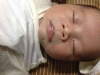 新生儿肺炎有什么症状 新生儿肺炎有什么症状 新生儿肺炎有哪些特点