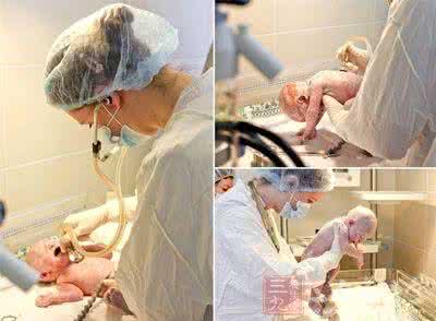 被诅咒的婴孩 动画片 剖腹产对妈妈与婴孩的危害