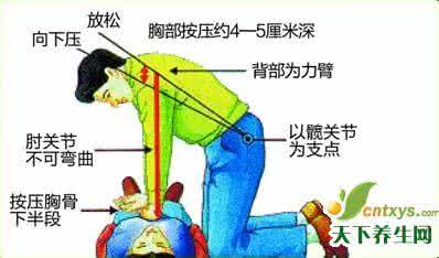 急救常识心肺复苏 心肺复苏怎么做——家庭急救常识