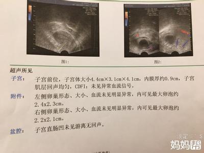 多囊备孕 多囊备孕2年，不放弃，终迎金鸡崽,NT已过