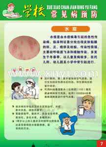脉曲张的祖传秘方 【祖传秘方】一张图推荐《祖传秘方：小儿水痘百治百愈》让孩子健康快乐每一天！