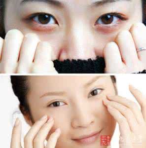 食疗去眼袋 食疗去眼袋 眼袋5病因 中医针灸配食疗治眼袋