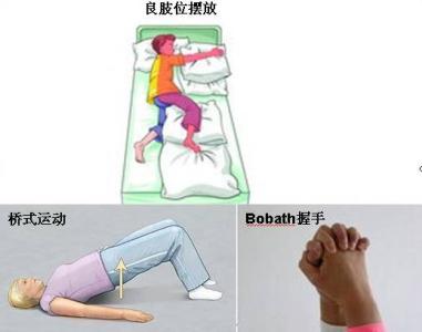 脑出血的症状及治疗 脑出血是什么 脑出血症状和治疗手段