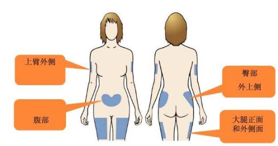 胰岛素的注射方法 胰岛素的注射与保存方法