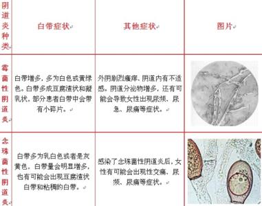 霉菌性阴倒炎用什么药 霉菌性阴道炎发病原因