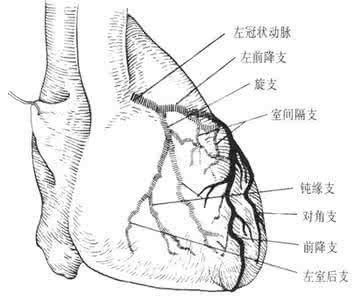 冠状动脉造影的副作用 冠状动脉造影