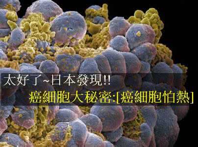 癌细胞怕热吗 癌细胞怕热 一天5杯热水完全排毒