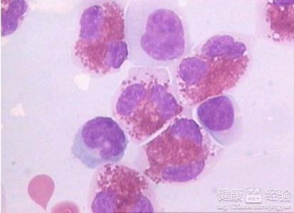 病毒性脑炎后遗症 病毒性脑炎后遗症 病毒性脑炎后遗症的治疗