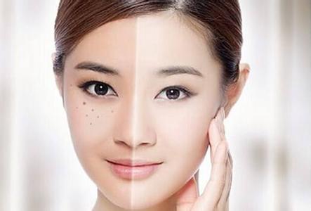 食疗去除黄褐斑 黄褐斑去除 食疗去除黄褐斑很简单