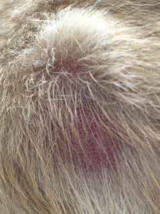 头皮屑多是皮肤病吗 头皮屑多是皮肤病吗 警惕！头皮屑过多应是皮肤病