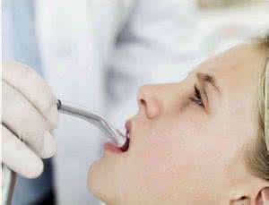 经期刚结束能拔牙吗 经期刚结束能拔牙吗 经期为什么不能拔牙?