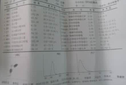 查转氨酶需要空腹吗 查转氨酶需要空腹吗 化验转氨酶需要空腹么?