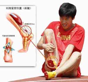 抑郁症的典型症状 抑郁症患者的典型症状 跟腱炎患者的典型症状