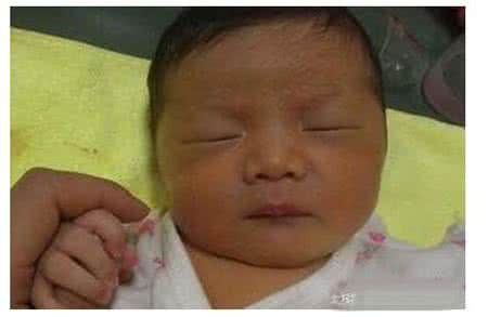 黄疸对新生儿的影响 黄疸对新生儿的影响 新生儿黄疸有什么影响