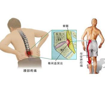 下肢发凉是怎么回事 下肢怕凉是怎么回事?