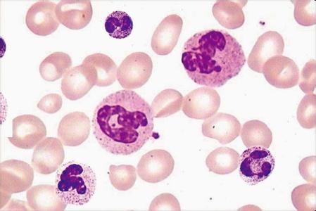 中性粒细胞的作用 中性粒细胞 中性粒细胞有什么作用