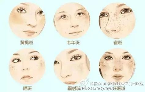 一白遮百丑一胖毁所有 一白遮百丑有斑毁所有 教你如何变成瓷肌女