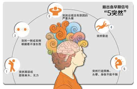 脑出血紧急处理 脑出血的发作信号与紧急处理