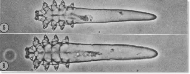 螨虫 螨虫 关于螨虫，你不知道的三件事