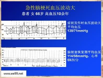 高血压患者血压波动大 怎么能控制高血压,如何控制血压波动