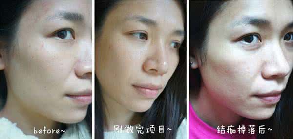 激光祛斑 斑斑点点动画片 激光祛斑 解除斑斑点点的烦恼