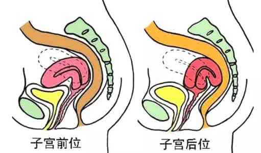 子宫后位想怀孕怎么办 子宫后位影响怀孕吗？