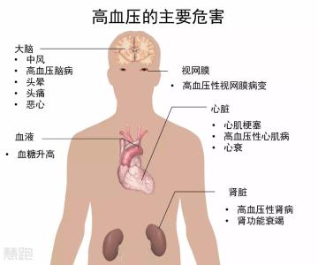 心脏支架后能跑步吗 做过心脏支架能跑步吗？