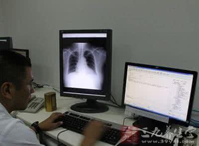 拍片报告 社区拍片半小时拿到大医院报告