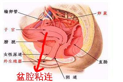 下腹部坠胀 盆腔充血 下腹坠胀可能是盆腔充血