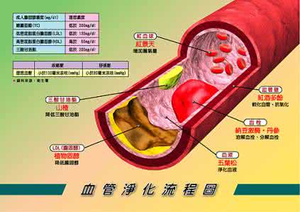 打通血管壁的中药秘方 【名医秘方】清理血管壁干净的特效方