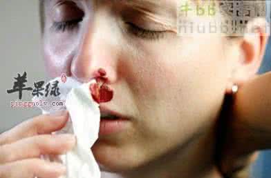 鼻出血症状 老年性鼻出血症状防治对策