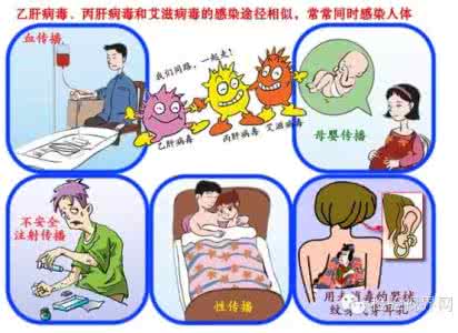 丙型肝炎的症状 丙型肝炎症状 丙型肝炎症状 主要体现这6大特征
