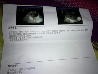 孕囊发育迟缓 吃什么有助孕囊发育?孕囊发育迟缓的原因